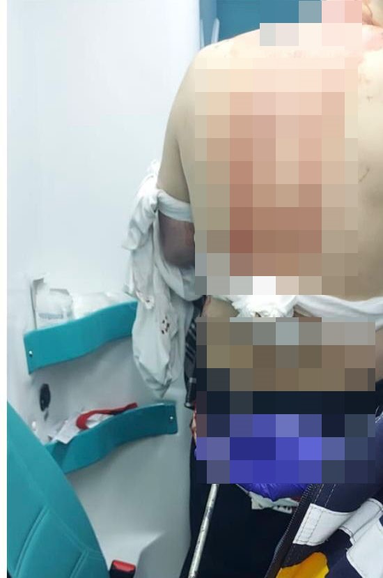 ABİSİNİ SOKAK ORTASINDA SİLAHLA VURARAK ÖLDÜRDÜ