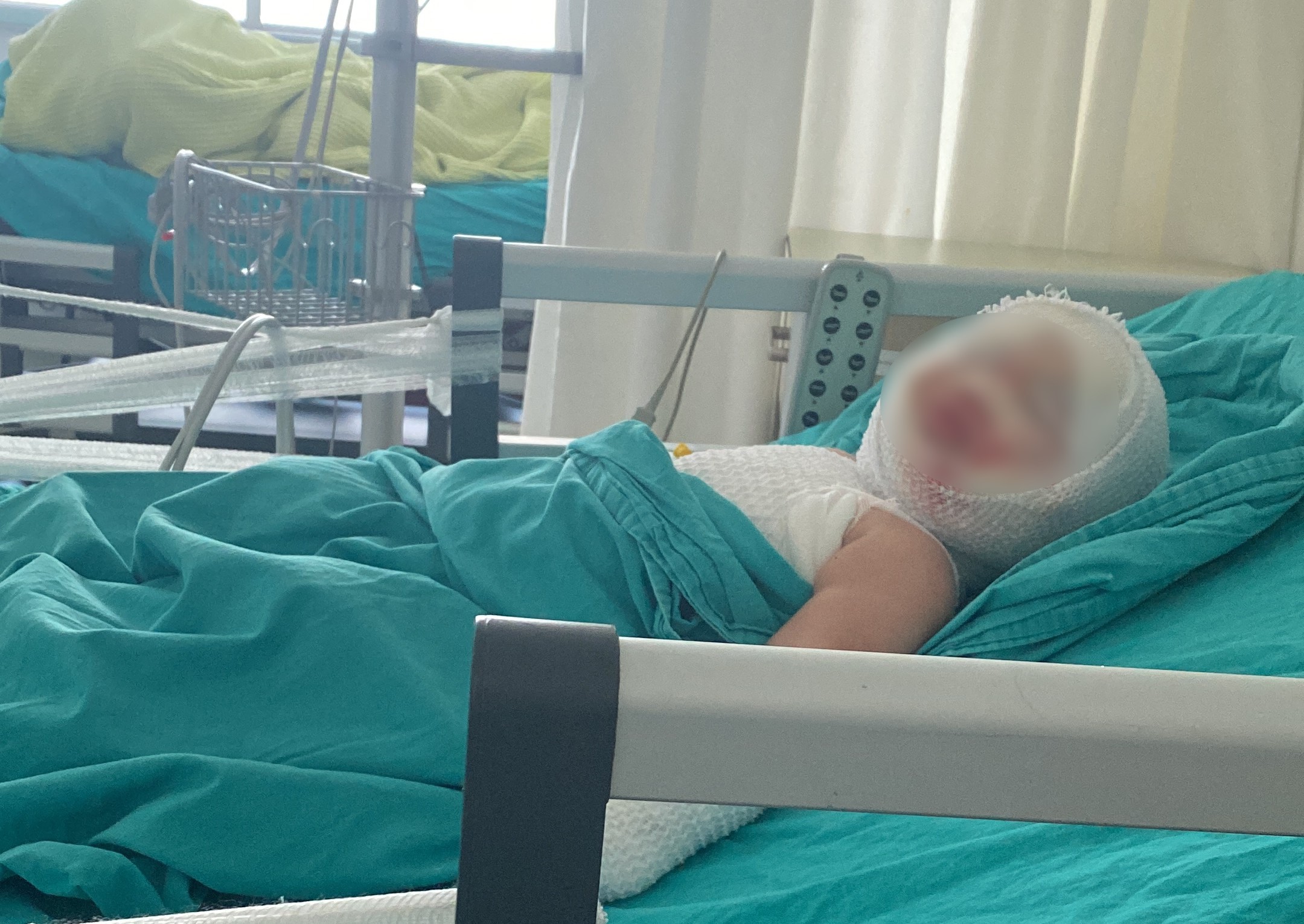 Mersin’de patlayan domates konservesi 9 aylık bebeği yaktı
